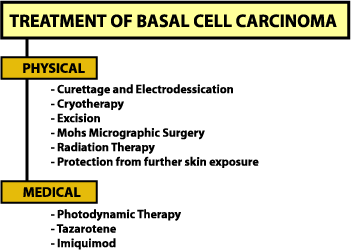 Treatment of Basal Cell Carcinoma